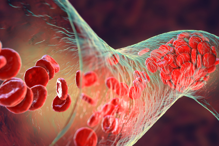 Inquest highlights role of guidelines - Avant