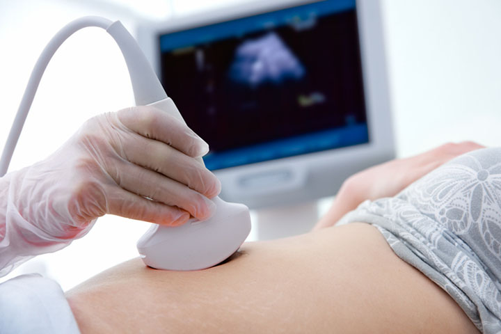 Women having ultrasound